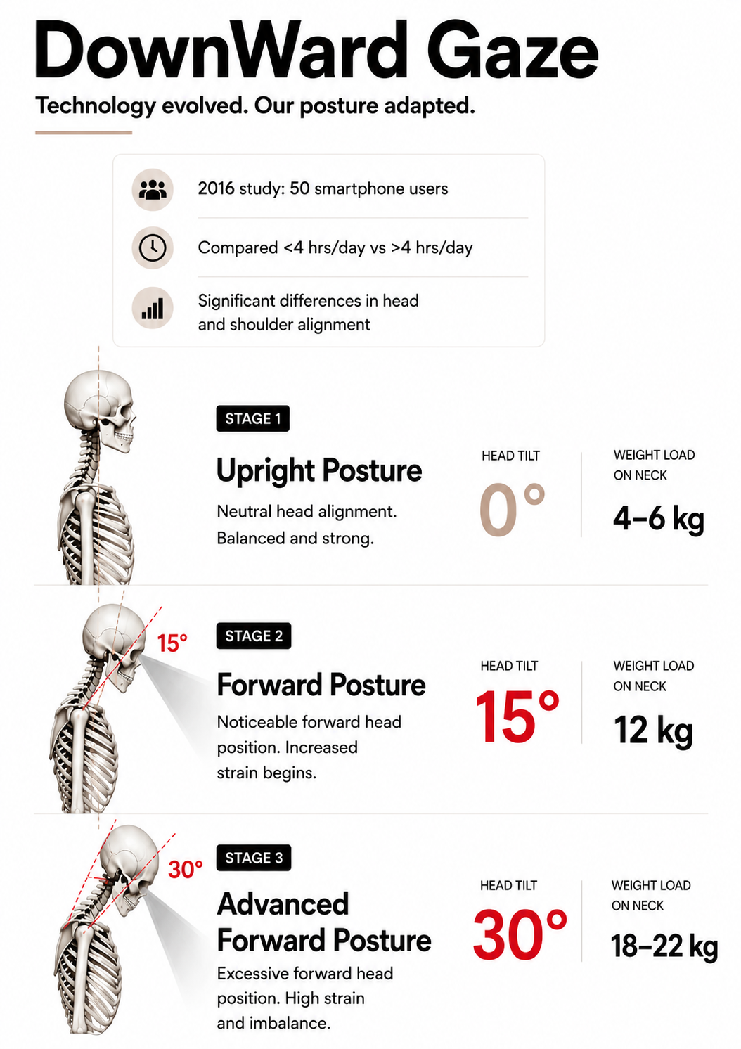 Posture evolution